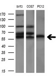 Anti-AKT2 antibody [4H7] used in Western Blot (WB). GTX84908