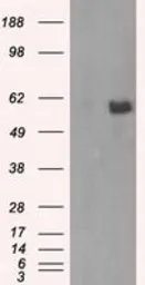 Anti-AKT2 antibody [4H7] used in Western Blot (WB). GTX84908