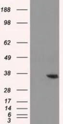 Anti-AKR1A1 antibody [6E3] used in Western Blot (WB). GTX84913