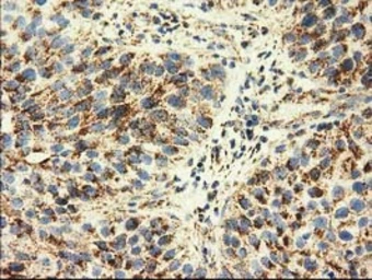 Anti-AK3 antibody [6B7] used in IHC (Paraffin sections) (IHC-P). GTX84929