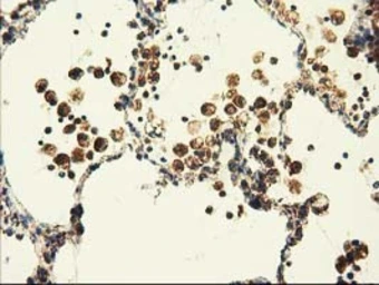 Anti-AK3 antibody [6B7] used in IHC (Paraffin sections) (IHC-P). GTX84929