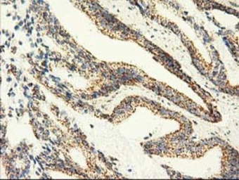 Anti-AK3 antibody [6B7] used in IHC (Paraffin sections) (IHC-P). GTX84929