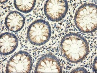 Anti-AK3 antibody [6B7] used in IHC (Paraffin sections) (IHC-P). GTX84929