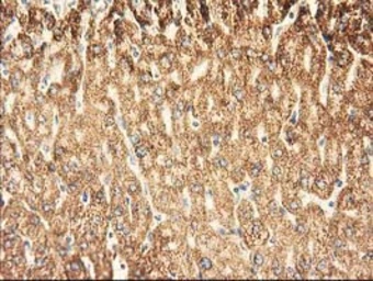 Anti-AK3 antibody [6B7] used in IHC (Paraffin sections) (IHC-P). GTX84929