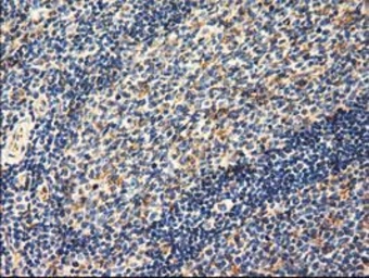 Anti-AK3 antibody [6B7] used in IHC (Paraffin sections) (IHC-P). GTX84929