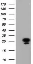 Anti-AK3 antibody [6B7] used in Western Blot (WB). GTX84929