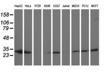 Anti-AK3 antibody [6B7] used in Western Blot (WB). GTX84929