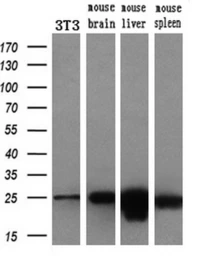 Anti-AK3 antibody [6D6] used in Western Blot (WB). GTX84931