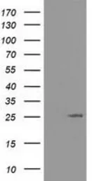 Anti-AK3 antibody [6D6] used in Western Blot (WB). GTX84931