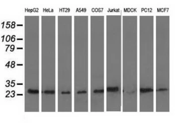 Anti-AK3 antibody [6D6] used in Western Blot (WB). GTX84931