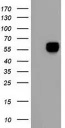 Anti-Alpha fetoprotein / AFP antibody [3B5] used in Western Blot (WB). GTX84950