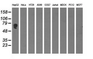 Anti-Alpha fetoprotein / AFP antibody [3B5] used in Western Blot (WB). GTX84950
