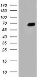 Anti-Alpha fetoprotein / AFP antibody [1E8] used in Western Blot (WB). GTX84953