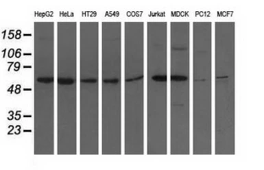 Anti-ADSL antibody [2D10] used in Western Blot (WB). GTX84956
