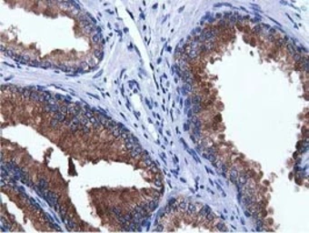 Anti-ADI1 antibody [5C2] used in IHC (Paraffin sections) (IHC-P). GTX84957
