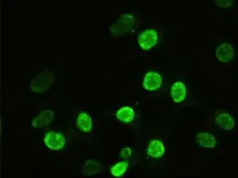 Anti-alpha Actinin antibody [7A4] used in Immunocytochemistry/ Immunofluorescence (ICC/IF). GTX84959