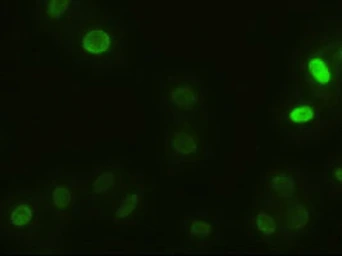 Anti-alpha Actinin antibody [7A4] used in Immunocytochemistry/ Immunofluorescence (ICC/IF). GTX84959