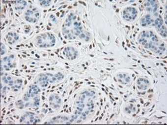 Anti-alpha Actinin antibody [7A4] used in IHC (Paraffin sections) (IHC-P). GTX84959