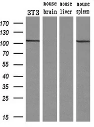 Anti-alpha Actinin antibody [7A4] used in Western Blot (WB). GTX84959