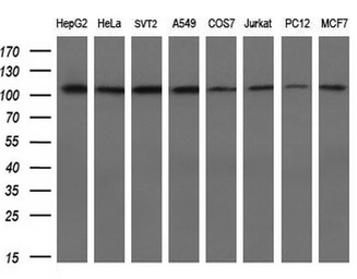 Anti-alpha Actinin antibody [7A4] used in Western Blot (WB). GTX84959