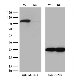 Anti-alpha Actinin antibody [7A4] used in Western Blot (WB). GTX84959