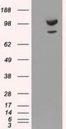 Anti-alpha Actinin antibody [7A4] used in Western Blot (WB). GTX84959