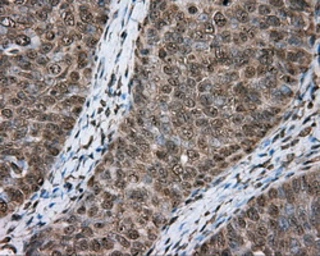 Anti-ACSBG1 antibody [2B6] used in IHC (Paraffin sections) (IHC-P). GTX84961