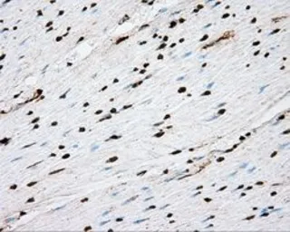 Anti-ACSBG1 antibody [2B6] used in IHC (Paraffin sections) (IHC-P). GTX84961