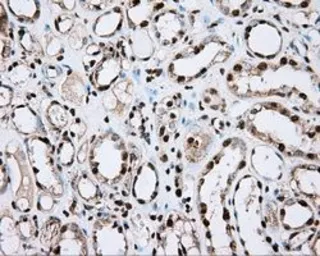 Anti-ACSBG1 antibody [2B6] used in IHC (Paraffin sections) (IHC-P). GTX84961
