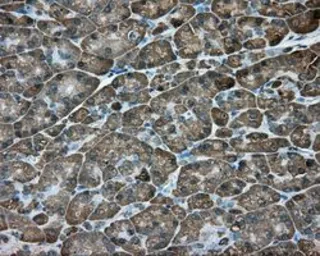 Anti-ACSBG1 antibody [2B6] used in IHC (Paraffin sections) (IHC-P). GTX84961