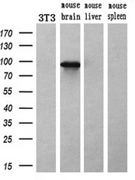 Anti-ACSBG1 antibody [2B6] used in Western Blot (WB). GTX84961