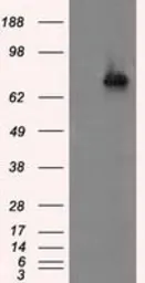 Anti-ACSBG1 antibody [2B6] used in Western Blot (WB). GTX84961