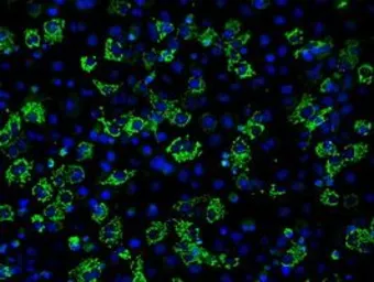 Anti-Aconitase 2 antibody [3G8] used in Immunocytochemistry/ Immunofluorescence (ICC/IF). GTX84963