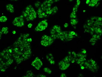 Anti-Aconitase 2 antibody [3G8] used in Immunocytochemistry/ Immunofluorescence (ICC/IF). GTX84963