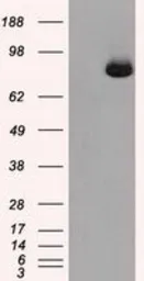 Anti-Aconitase 2 antibody [3G8] used in Western Blot (WB). GTX84963