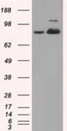Anti-Aconitase 2 antibody [7G4] used in Western Blot (WB). GTX84965
