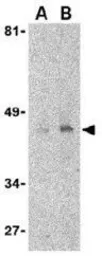 Anti-DC-SIGN antibody [8B6] used in Western Blot (WB). GTX84993