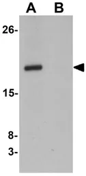 Anti-CXXC4 antibody used in Western Blot (WB). GTX84996