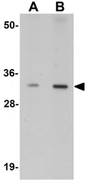 Anti-MOX1 antibody used in Western Blot (WB). GTX84998