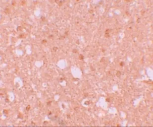 Anti-TRIM71 antibody used in IHC (Paraffin sections) (IHC-P). GTX85001