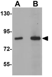 Anti-TRIM71 antibody used in Western Blot (WB). GTX85001