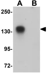 Anti-ATP11B antibody used in Western Blot (WB). GTX85003