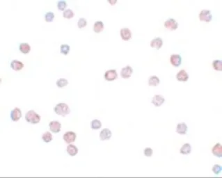 Anti-ATP11B antibody used in Immunocytochemistry/ Immunofluorescence (ICC/IF). GTX85003