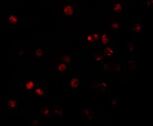 Anti-ATP11B antibody used in Immunocytochemistry/ Immunofluorescence (ICC/IF). GTX85003