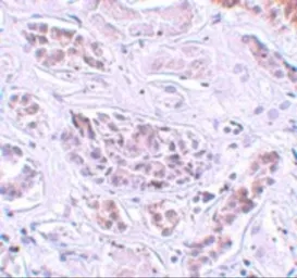 Anti-ATG3 antibody used in IHC (Paraffin sections) (IHC-P). GTX85005