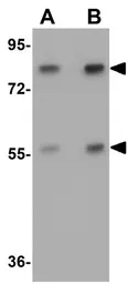 Anti-APC4 antibody used in Western Blot (WB). GTX85006