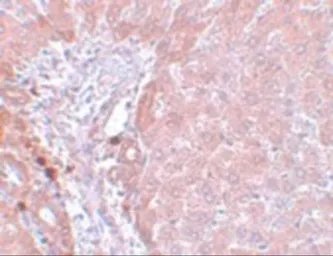 Anti-NDUFB9 antibody used in IHC (Paraffin sections) (IHC-P). GTX85007