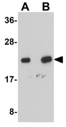 Anti-NDUFB9 antibody used in Western Blot (WB). GTX85007
