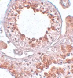 Anti-ESX1 antibody used in IHC (Paraffin sections) (IHC-P). GTX85009