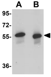 Anti-SKA3 antibody used in Western Blot (WB). GTX85013